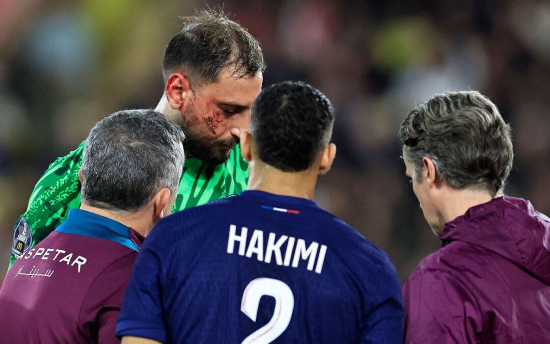 PSG keeper Donnarumma injured by cleat to face​​